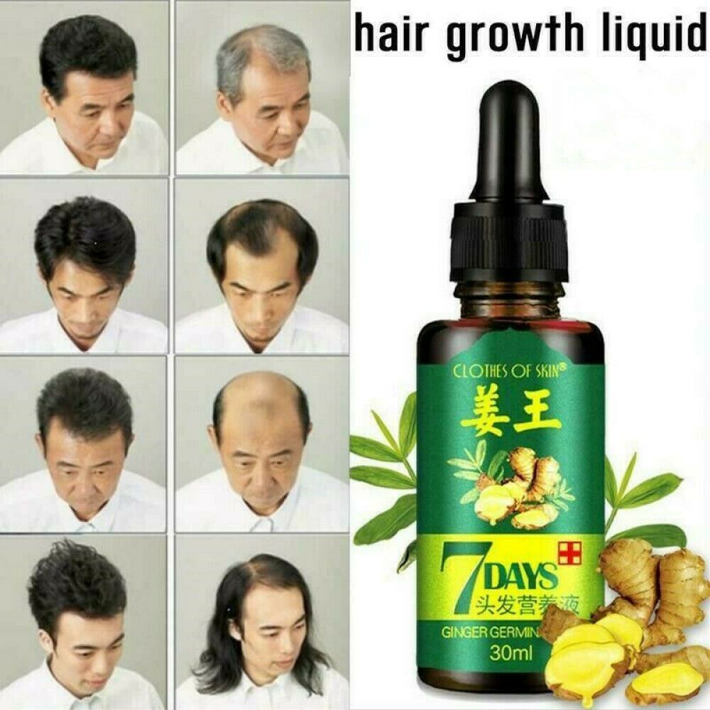 7 Day Ginger Germinal Oil Hair Nutrient Solution Hair Growth Essence Liquid Fast Natural Hair Loss Treatment Hair Care (30ml) 8