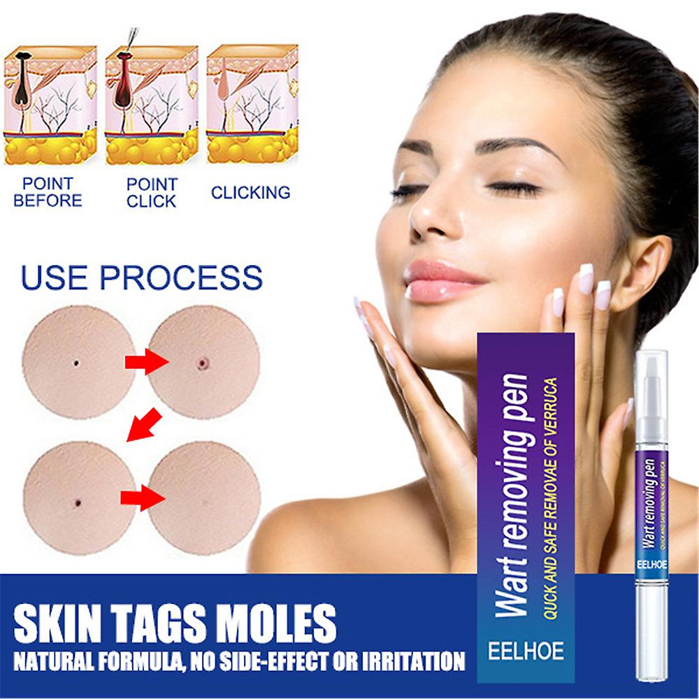 Warts Remover Original Cream Wart Removal Ointment Wart Treatment Skin Tag Mole Remover Antibacterial Foot Wart 1
