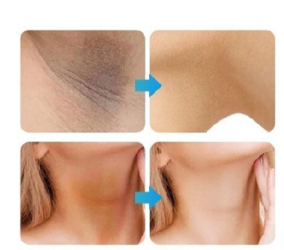 Whitening Cream for sensitive Areas underarm and private Areas - 30g buy online in Pakistan