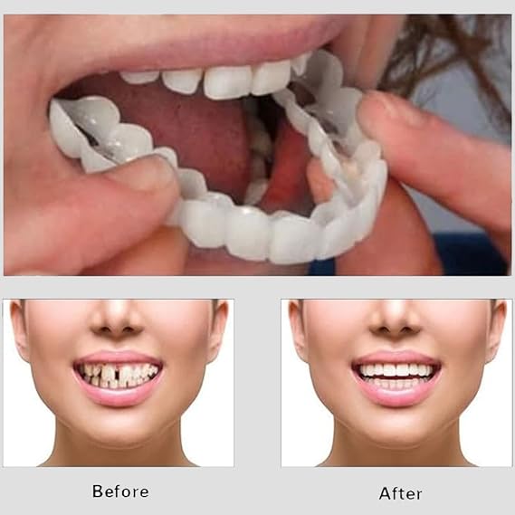 Snap On Smile - Veneers Teeth for Men and Women - Moldable False Artificial Braces Teeth buy online in Pakistan