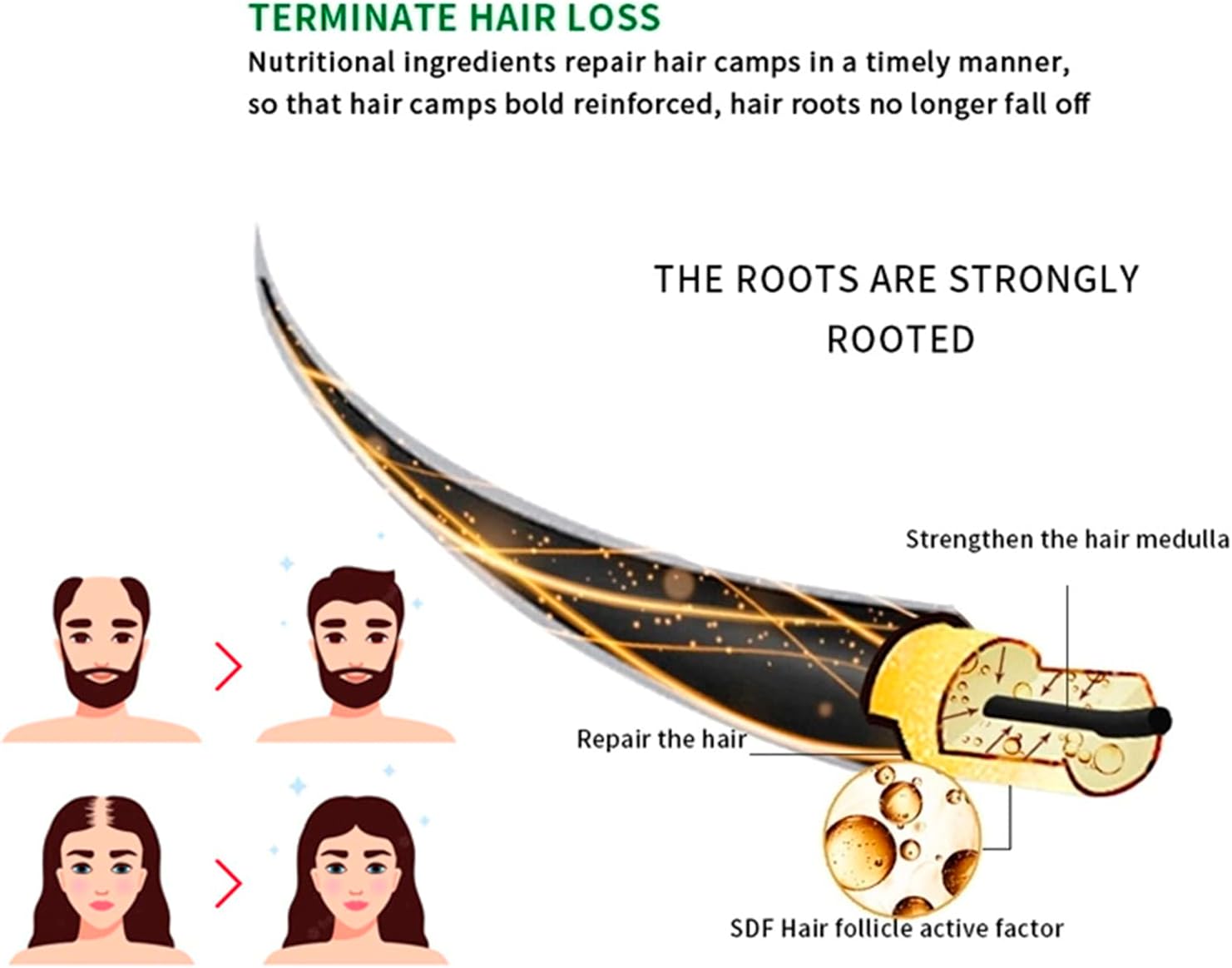 Anti-Hair Loss Spray Tonic Deep Moisturize Nourish Repair Strengthen Hair Root Anti-Frizz Care 30ml view 4