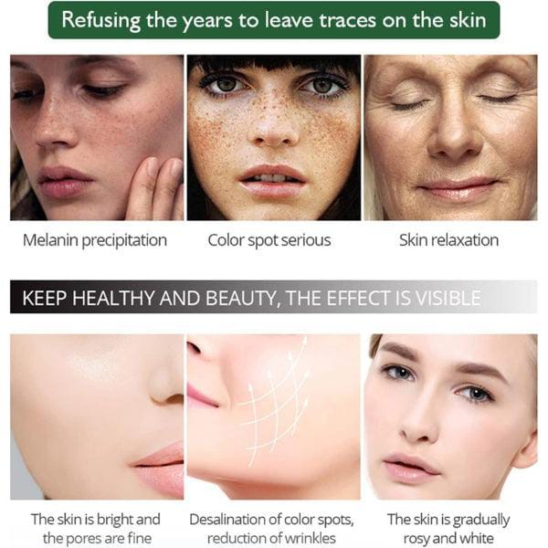 100% original Aichun Anti Freckle Whitening Facial Serum 30ml view 5