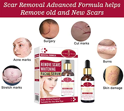 AICHUN BEAUTY Scar Removal Facial Serum Pimples Stretch Marks Face Moisturizing Body Remove Scars Kojic Acid Vitamin E 30ml view 5