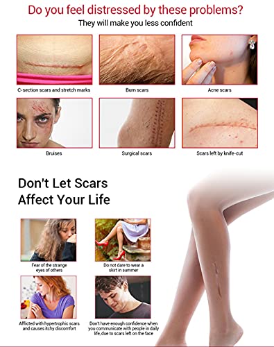 AICHUN BEAUTY Scar Removal Facial Serum Pimples Stretch Marks Face Moisturizing Body Remove Scars Kojic Acid Vitamin E 30ml view 4