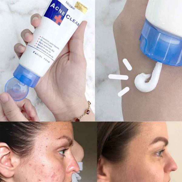 Mistine Acne Clear Face Wash Facial Foam 85 ml view 3