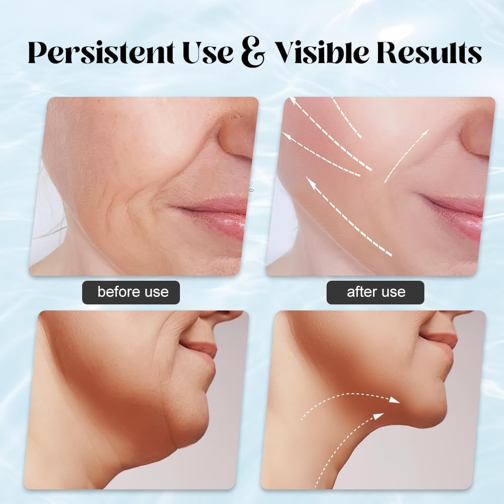 Massager for Face Lifting Facial Massagers EMS Neck Eye Massage Instrument Vibrator Microcurrents Red Light Therapy Anti Wrinkle - Random Color buy online in Pakistan
