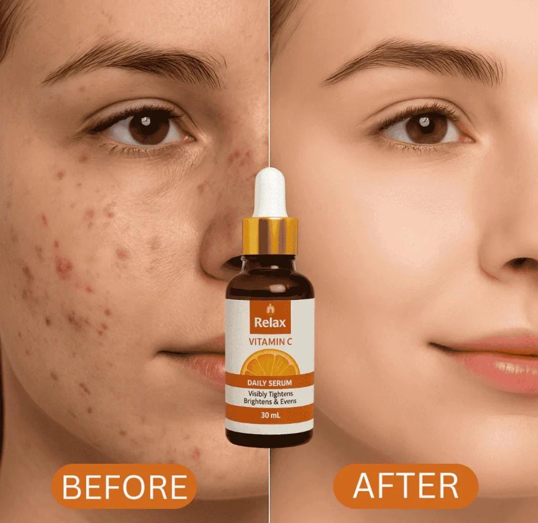 Relax Vitamin C Daily Serum – Brightening & Anti-Aging Face Serum - 30ml buy online in Pakistan