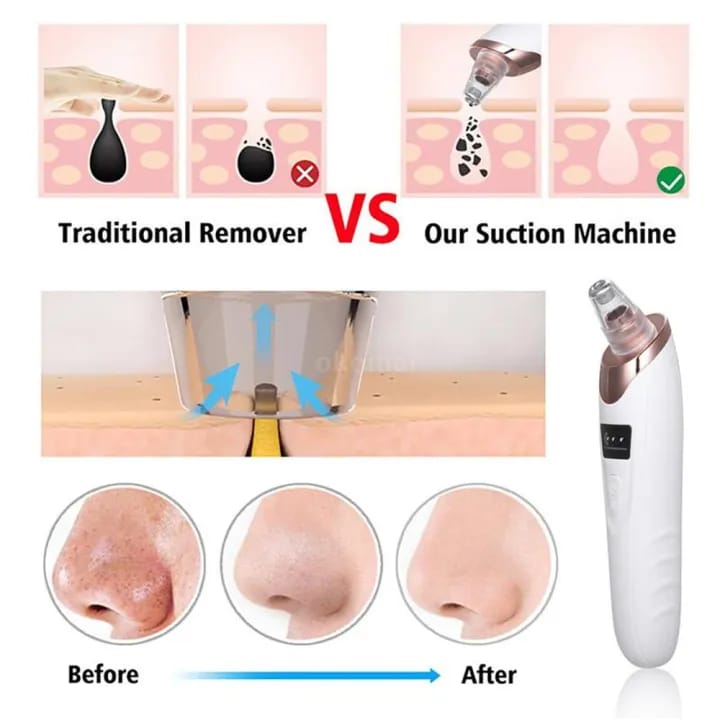 Face Vacuum Suction Blackhead Remover Pore Cleaner Electric Deep Cleansing Tool For Nose And Face view 5