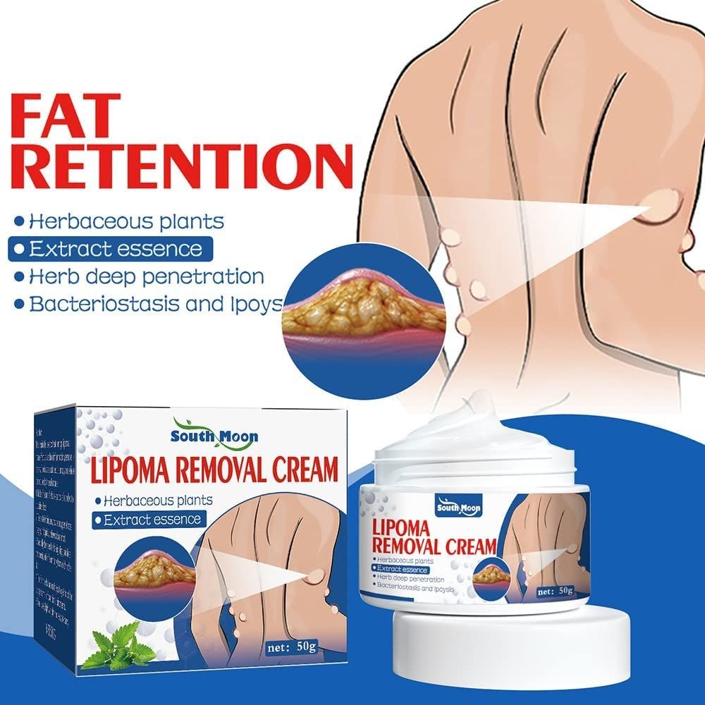 South Moon Lipoma Removal And Body Smoothing Cream 50g Herbal Natural Lump And Skin Knot Relief Ointment buy online in Pakistan