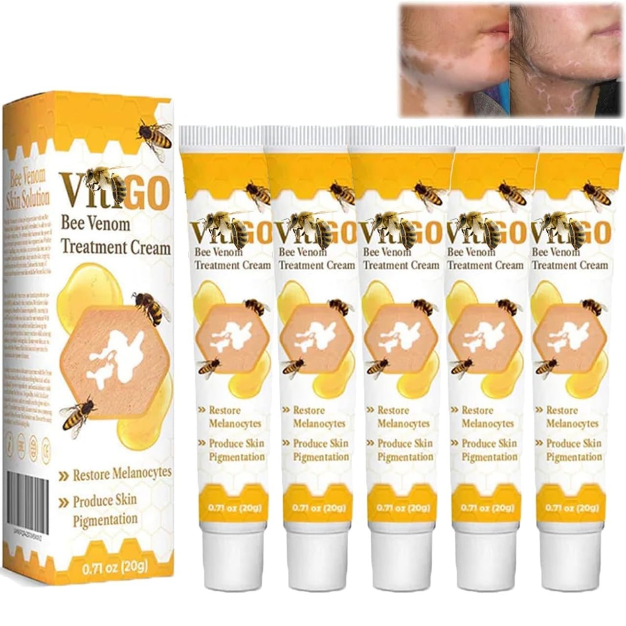 Fivfivgo™ VitiGO Bee Venom Correcting Cream (20g) Support for Skin Pigmentation Recovery and Even Skin Tone buy online in Pakistan