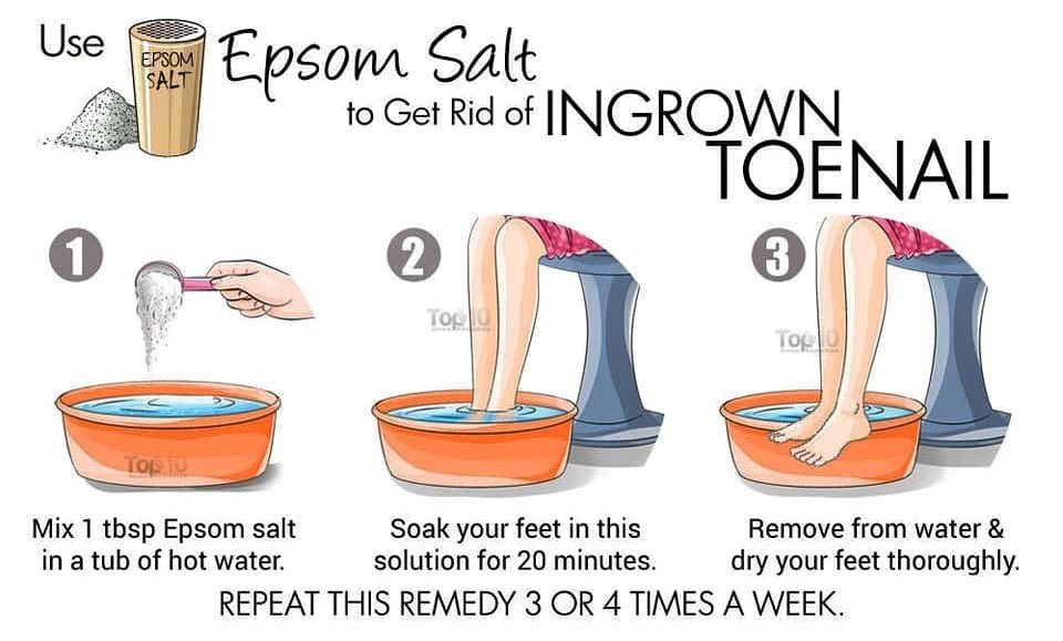 1Kg Epsom Salt Natural Mineral Fertilizer / Beauty Health thumbnail 3