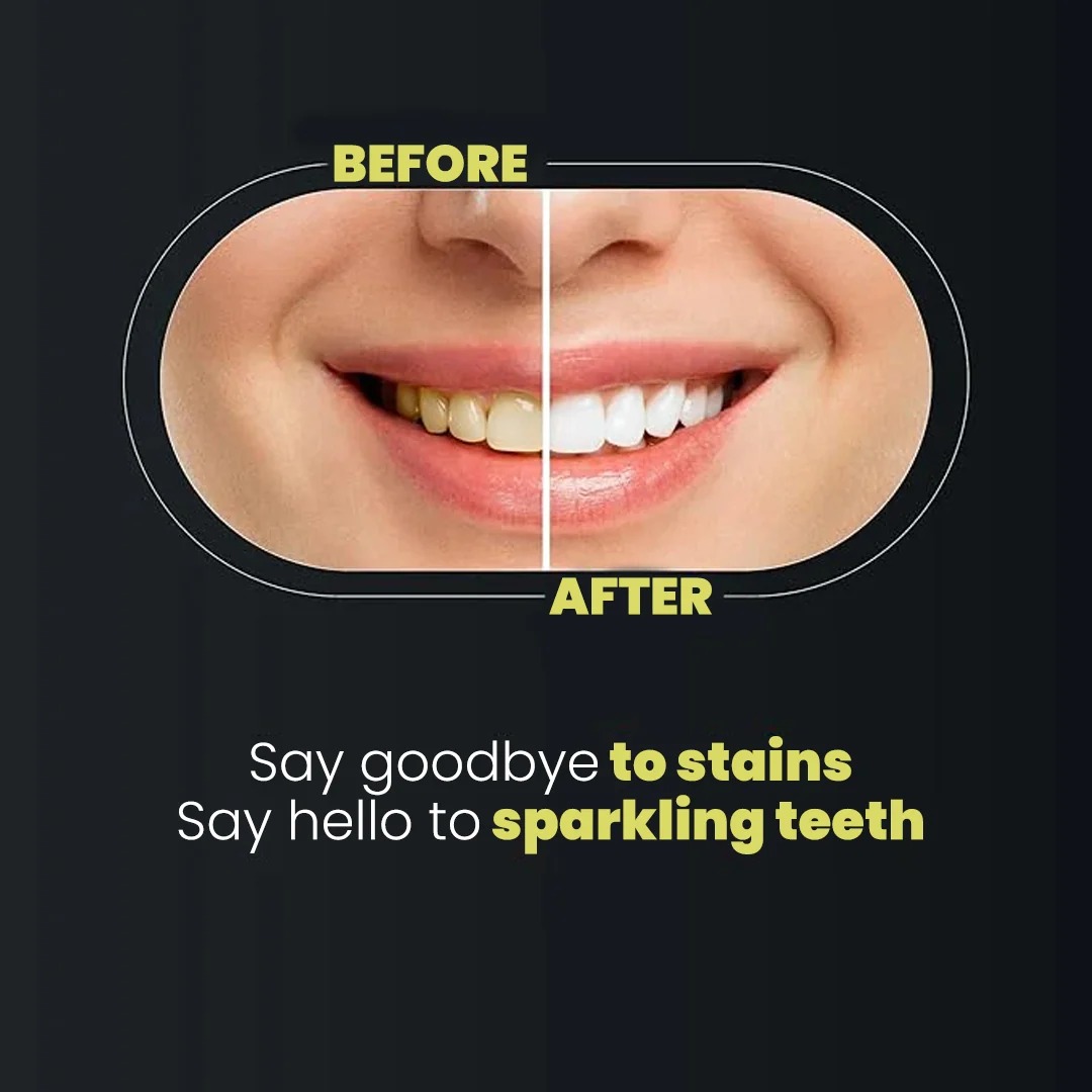 Teeth Whitening Strips 3D Gentle Stain Removing Enamel Safe Bright Smile Daily Treatment 14 Strips
