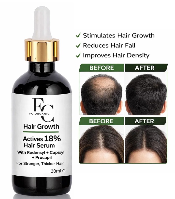 Herbal Hair Growth Serum 30ml | Rosemary & Onion Water-Based Formula thumbnail 2