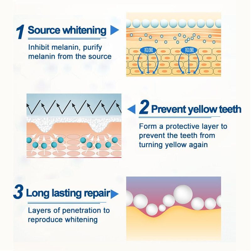 Dazzling White Instant Teeth Whitening Pen thumbnail 5