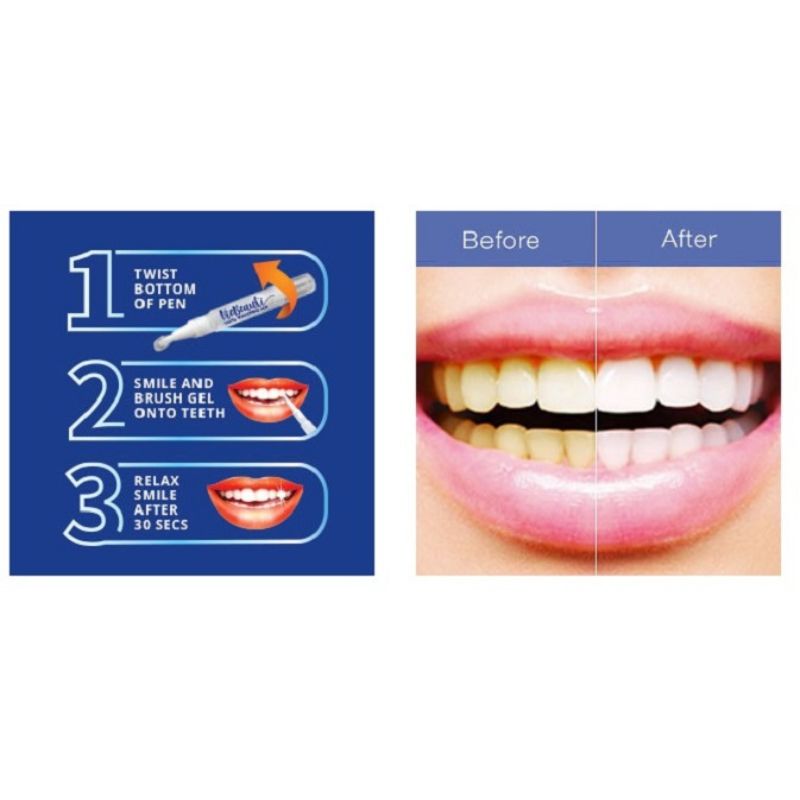 Dazzling White Instant Teeth Whitening Pen thumbnail 4