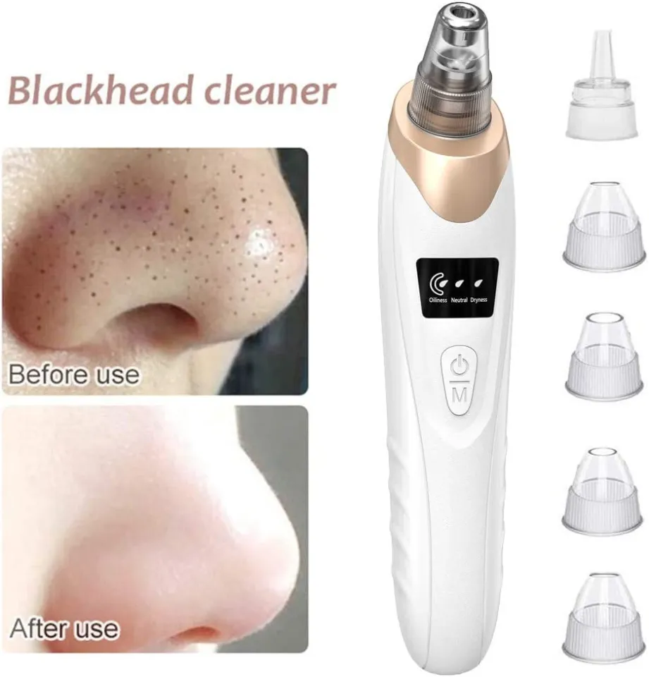 5 In 1 Blackhead Remover Machine Rechargeable Pore Cleaner - Skincare Device Designed For Pore Cleansing And Daily Beauty Routine thumbnail 3