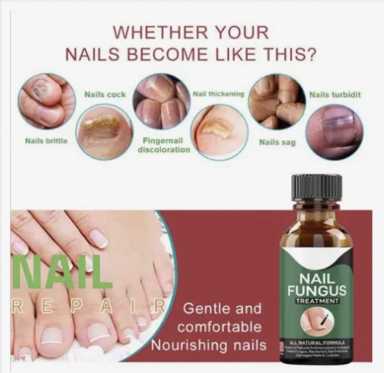 Fast Nail Fungus Treatment Serum 15ml All Natural Formula For Finger And Toenail Care Repairs Damaged Nails Cuticles And Supports Healthy Growth thumbnail 4