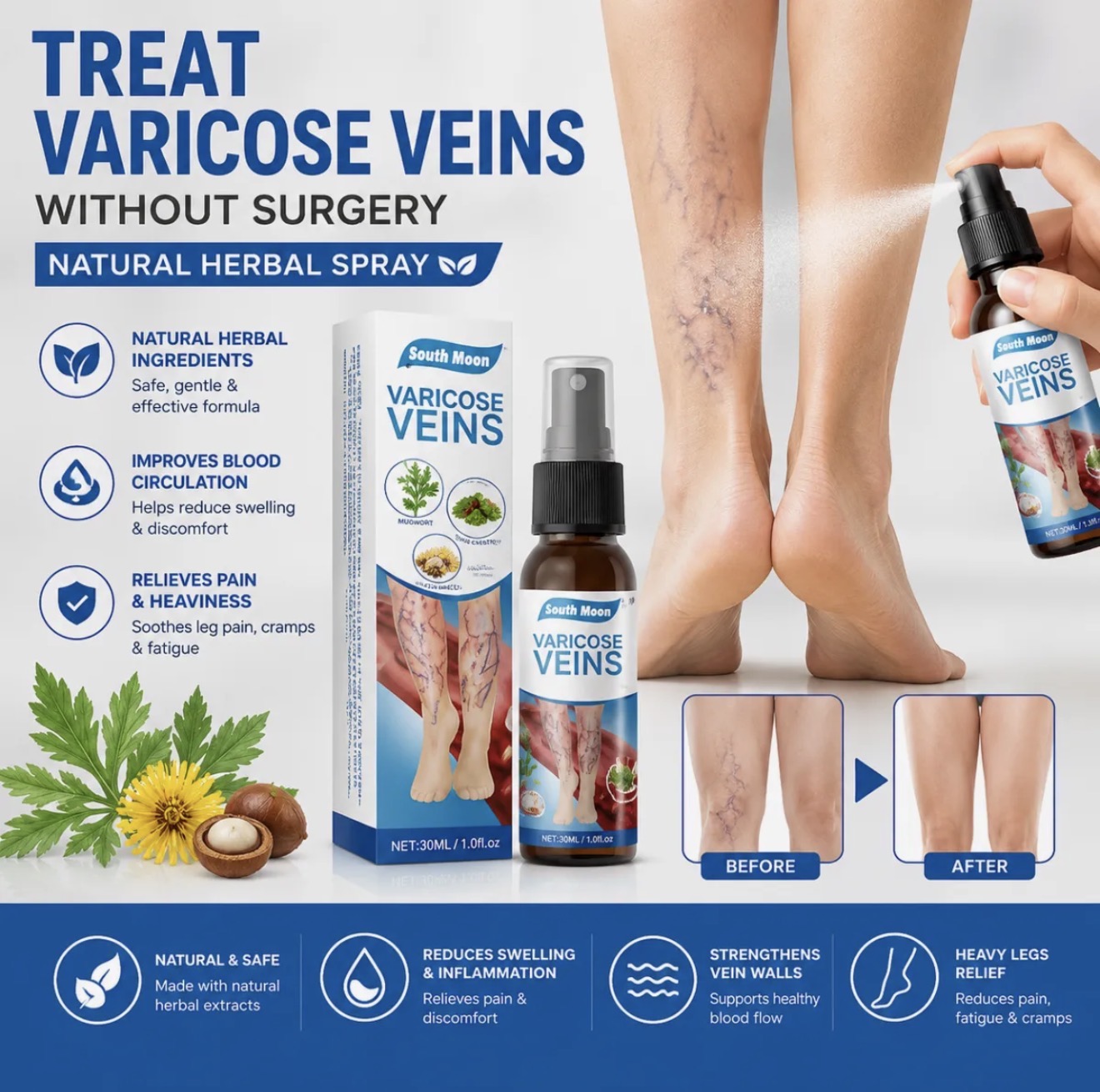 Natural Herbal Varicose Veins Spray South Moon Vein Care Spray 30ml Soothing Relief Formula For Healthy Legs And Improved Circulation thumbnail 2