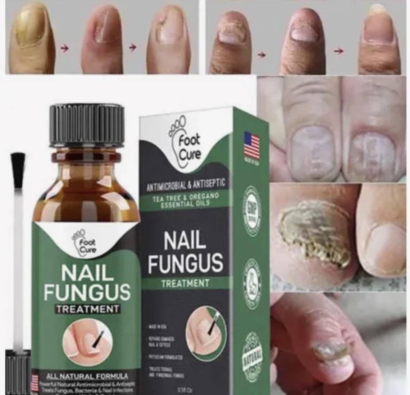 Fast Nail Fungus Treatment Serum 15ml All Natural Formula For Finger And Toenail Care Repairs Damaged Nails Cuticles And Supports Healthy Growth thumbnail 3