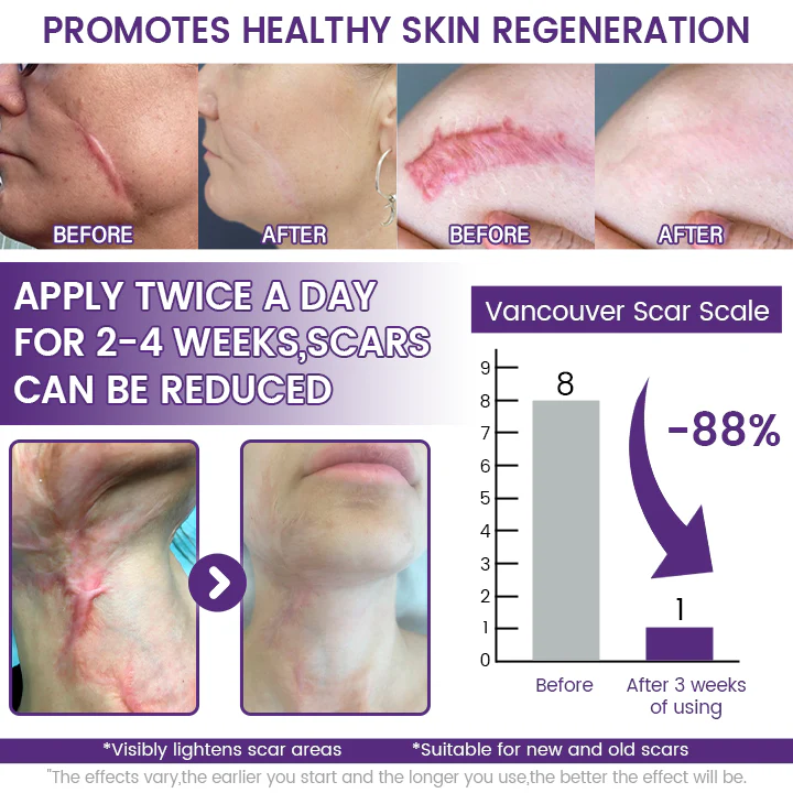 Timilk REGENSCAR Stem Cell Scar Gel provides a triple-action formula to help lock-in moisture - 20g view 4