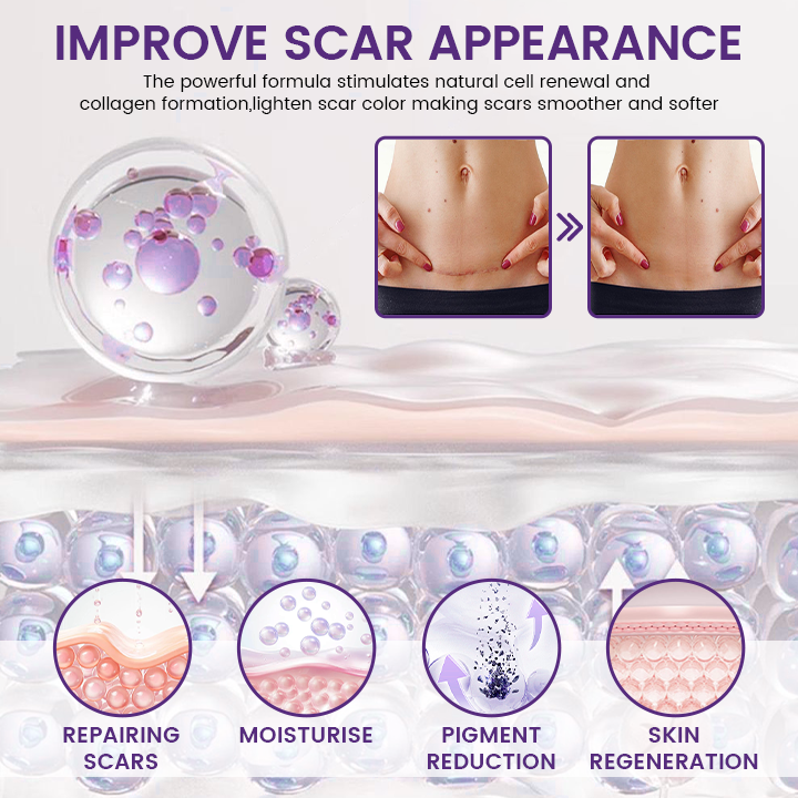 Timilk REGENSCAR Stem Cell Scar Gel provides a triple-action formula to help lock-in moisture - 20g view 3